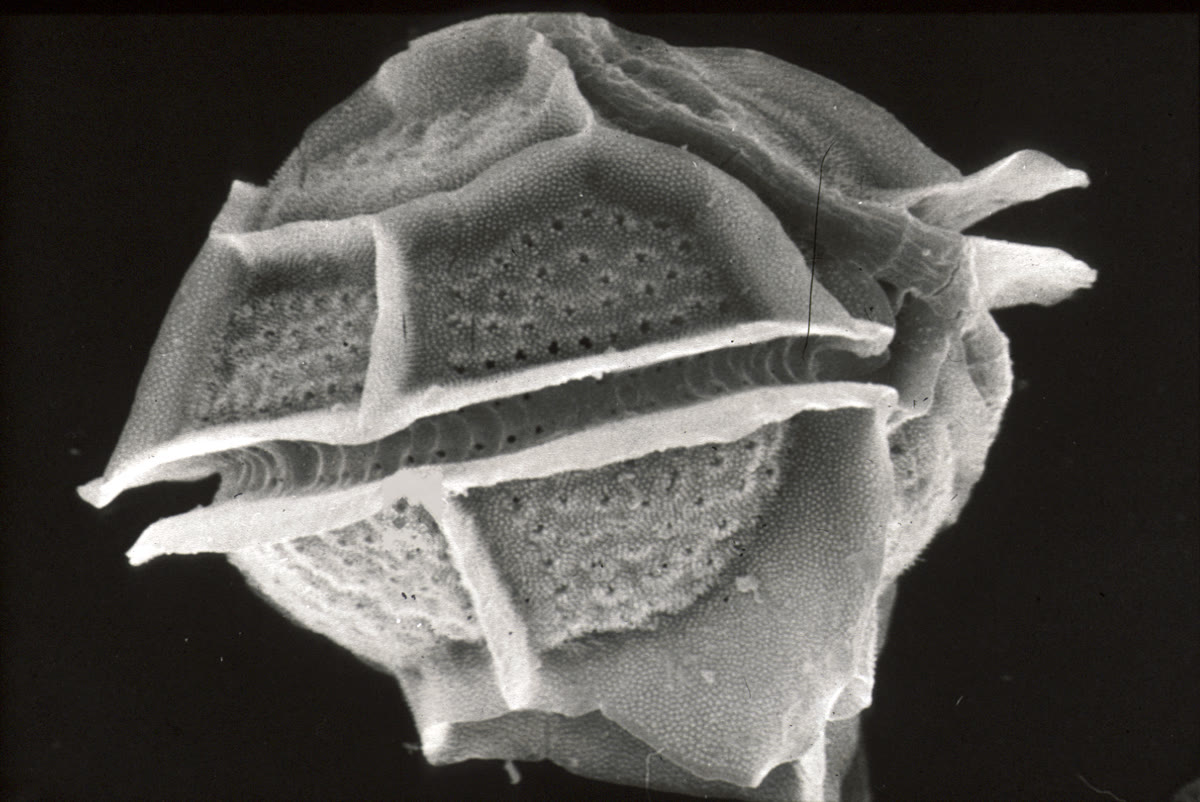 Electron microscope image of Pyrodinium bahamense, an armored single-celled dinoflagellate